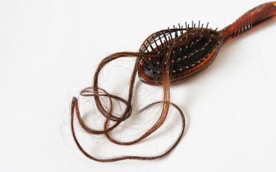 ปัญหาไม่เบากับเรื่องผมบาง